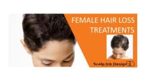 female hair loss treatments available at scalp ink design in south Florida Miami Margate West Palm Beach
