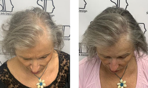 Hair Density - Scalp micropigmentation for women - Florida Scalp Ink Design